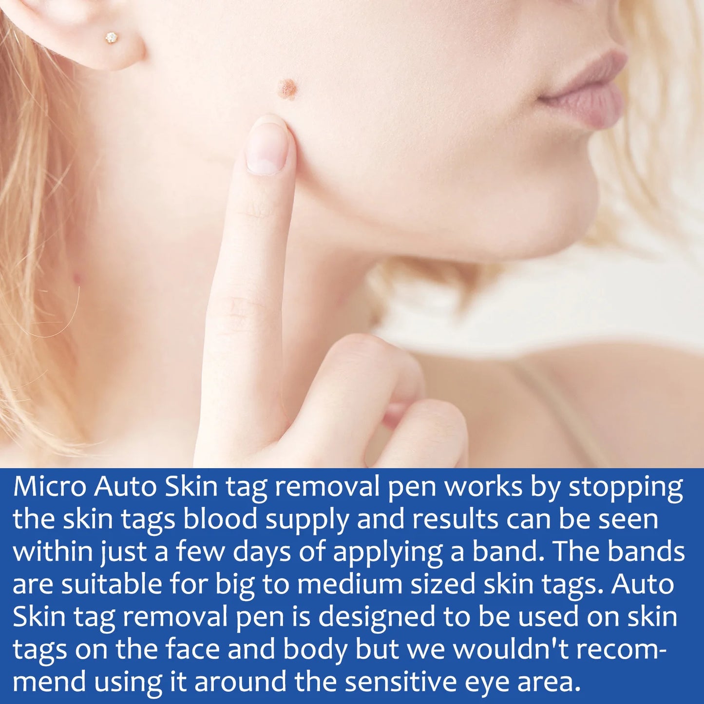 2 In1 Painless Auto Skin Tag Mole Wart Removal Kit