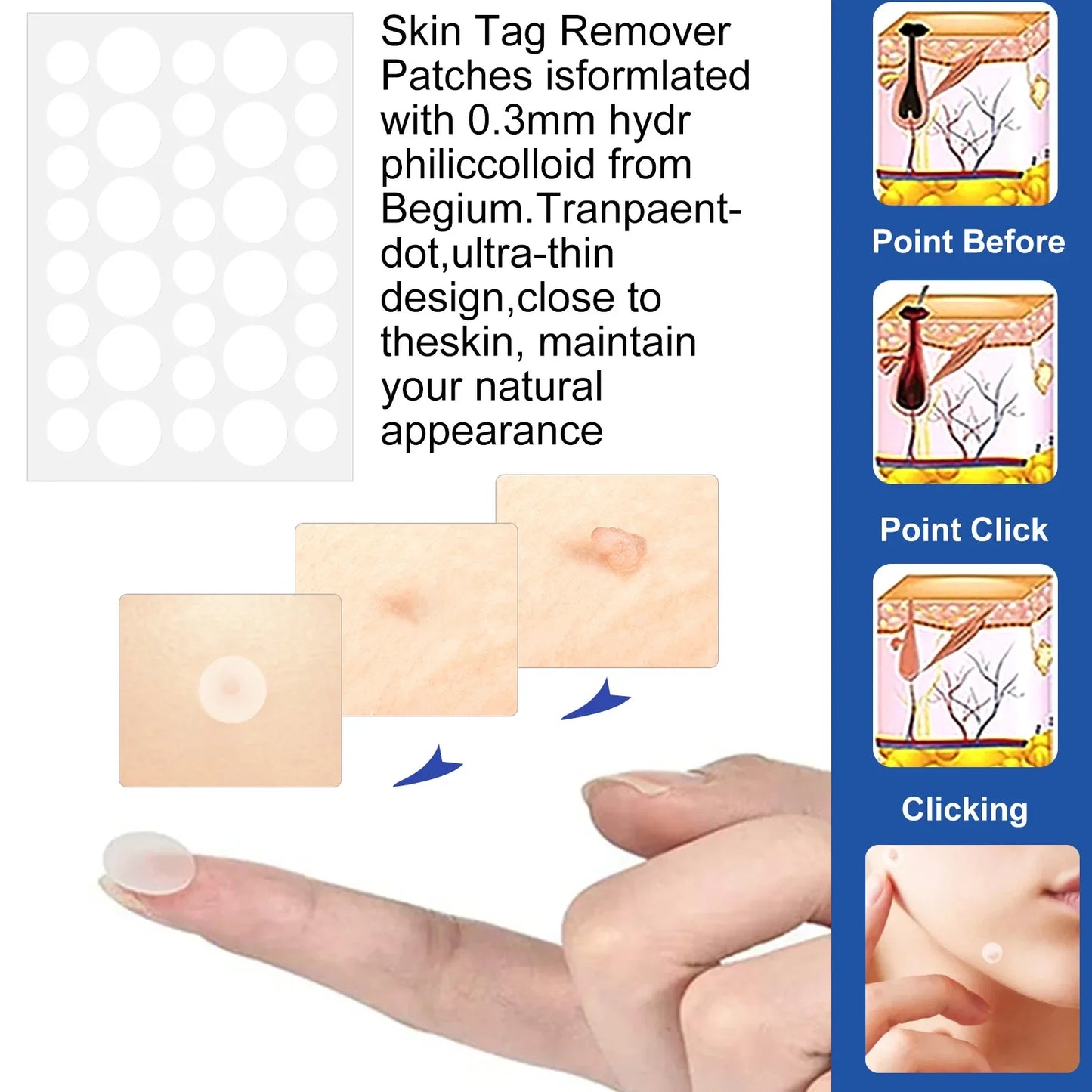 2 In1 Painless Auto Skin Tag Mole Wart Removal Kit