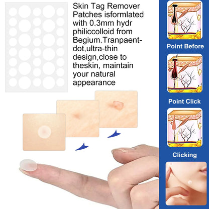 2 In1 Painless Auto Skin Tag Mole Wart Removal Kit